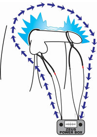 Zeus Vigor Ii Cock and Ball Ties Estim